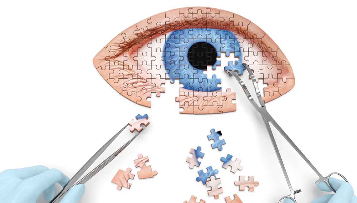 Corneal Transplants